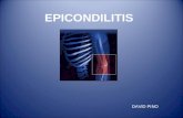 Tratamiento Epicondilitis Evidencia Cintifica