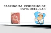 DERMATOLOGIA CARCINOMA EPIDERMOIDE ESPINOCELULAR