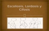 Escoliosis Lordosis y Cifosis