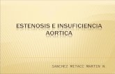 Estenosis e Insuficiencia Aortica