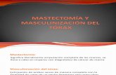 Exposición Mastectomía y Masculinización Tórax