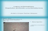 Lupus Eritematoso, Depósito amiloide, esclerodermia