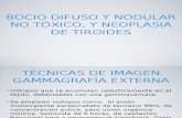 Bocio difuso, nodular no tóxico y neoplasia de tiroides