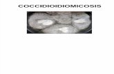 Coccidioidomicosis ehl