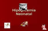 Hipoglicemia e Hiperglicemia