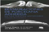 Restauraciones de Porcelana Adherida - Pascal Magne - Spanish