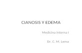 Cianosis y Edema