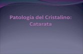CAS OFTALMO Patología del Cristalino.ppt