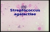 Tema 14 Streptococcus Agalactiae