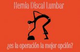 Hernia Discal ¿es la operación la mejor opción?