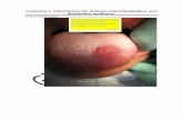 lesiones en el sistema masticatorio por piercings