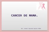 Cancer de mama 1ra parte