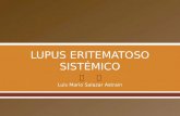 LUPUS ERITEMATOSO SISTEMICO, ENFERMEDAD MIXTA DE TEJIDO CONJUNTIVO, SÍNDROME SJOGREN