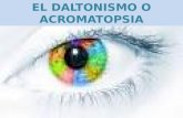 Daltonismo o acromatopsia