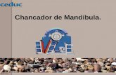 CHANCADOR DE MANDIBULA