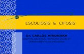 Cifosis   Escoliosis