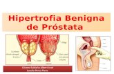 Hipertrofia benigna de próstata USP