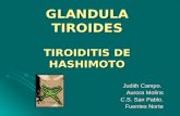 (2011 10-04) tiroides hashimoto (ppt)
