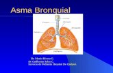 Asma Bronquial Dr. Rivera
