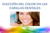 Carillas dentales y el color