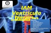IAM Ventriculo Derecho - Enzimas Cardiacas - PAE (Proceso de Enfermería) 2013