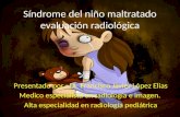 Sindrome del niño maltratado evaluacion radiologica