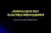 Semiologia Del Ekg