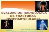 Evaluacion  radiologica de fracturas