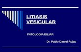 Litiasis vesicular Clase N°15