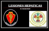 Lesiones hepaticas dr morel