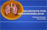 Neumonitis por Hipersensibilidad