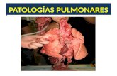 # 3 patologías pulmonares