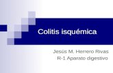 Colitis isquémica