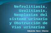 Presentación nefrolitiasis, urolitiasis, neoplasias de las vía urinaria