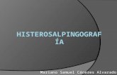 Histerosalpingografía e Histerosonografía