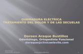 Quemadura electricaQUEMADURA ELÉCTRICATRATAMIENTO DEL DOLOR Y DE LAS SECUELAS