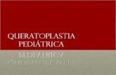 Queratoplastia Pediátrica