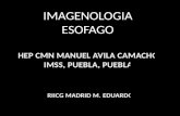 02.imagenología de esofago
