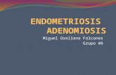 Endometriosis y Adenomiosis