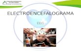 EEG Electroencefalograma