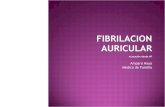 Fibrilacion auricular[2]