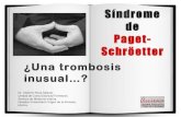 Protocolo región de Murcia de trombosis miembro superior: Sd. Paget-Schröetter. Arm deep vein thrombosis