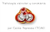 Curso TCAE - Patología coronaria y valvular