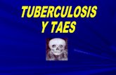Tuberculosis y taes