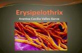 Erysipelothrix rhusiupathiae