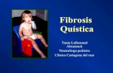 Fibrosis quistica iiii