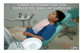 Tomas FotográFicas Para Ortodoncia (Con Espejos)