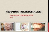 Hernias incisionales
