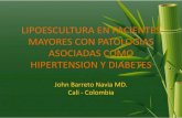 Ponencia presentada por el Doctor John Barreto a la Sociedad Americana y Brasilera de Cirugía Plastica