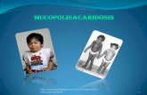 Mucopolisacaridosis presentacion final